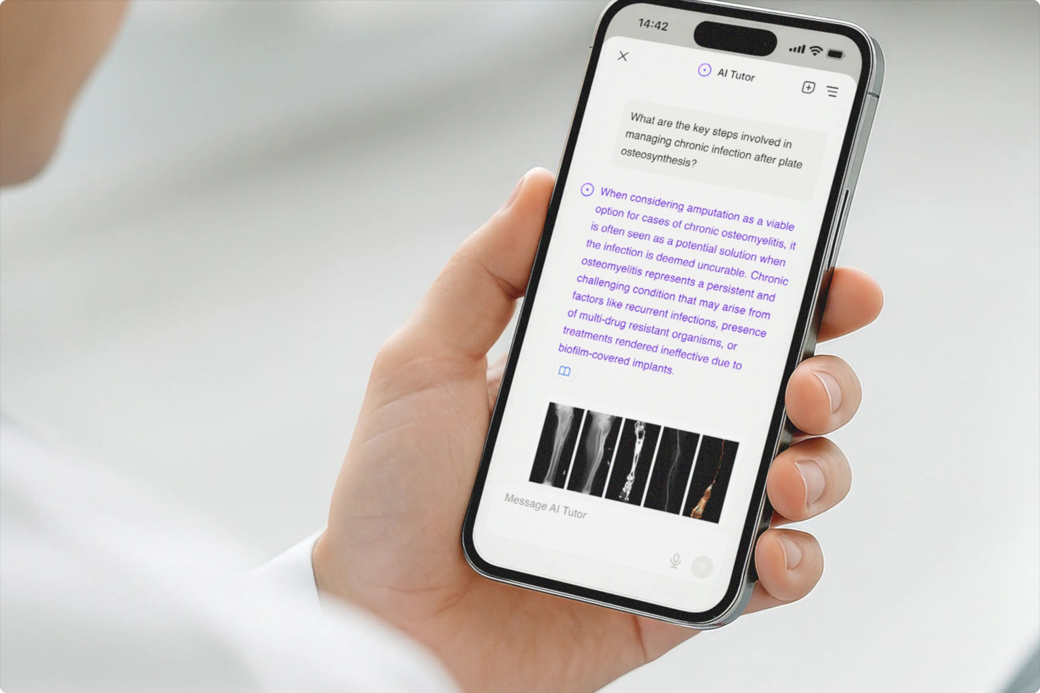 AO Foundation case study UI examples